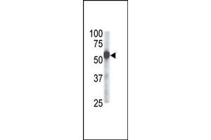 Image no. 1 for anti-Zinc Metalloproteinase, Ste24 (Zmpste24) (Middle Region) antibody (ABIN357707) (ZMPSTE24 抗体  (Middle Region))