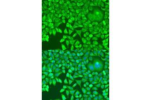 Immunofluorescence analysis of U2OS cells using Pumilio 1 antibody (ABIN6132539, ABIN6146494, ABIN6146496 and ABIN6217367) at dilution of 1:100. (PUM1 抗体  (AA 1-130))