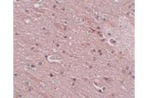 Immunohistochemistry of FRMPD4 in human brain tissue with this product at 5 μg/ml. (Anoctamin 2 抗体  (N-Term))