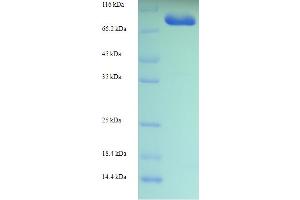 SDS-PAGE (SDS) image for Myosin XIX (MYO19) (AA 2-770) protein (His-SUMO Tag) (ABIN5711561) (Myosin XIX Protein (MYO19) (AA 2-770) (His-SUMO Tag))