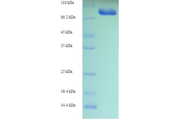 Myosin XIX Protein (MYO19) (AA 2-770) (His-SUMO Tag)