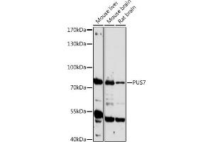 Western blot analysis of extracts of various cell lines, using PUS7 antibody (ABIN7269739) at 1:1000 dilution. (PUS7 抗体  (AA 352-661))