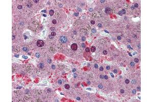 Immunohistochemistry (IHC) image for anti-CUGBP, Elav-Like Family Member 1 (CELF1) (Middle Region) antibody (ABIN2778749) (CELF1 抗体  (Middle Region))