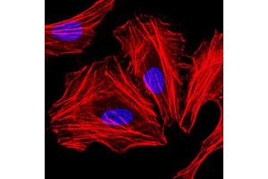Immunocytochemistry (ICC) image for anti-CCAAT/enhancer Binding Protein (C/EBP), alpha (CEBPA) antibody (ABIN1845802) (CEBPA 抗体)