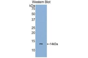 Detection of Recombinant GCSFR, Human using Polyclonal Antibody to Colony Stimulating Factor Receptor, Granulocyte (GCSFR) (CSF3R 抗体  (AA 26-138))