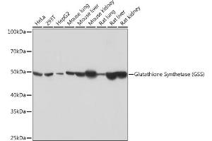 Western blot analysis of extracts of various cell lines, using Glutathione Synthetase (GSS) (GSS) Rabbit mAb (ABIN7267452) at 1:1000 dilution. (Glutathione Synthetase 抗体)