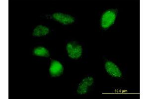 Immunofluorescence (IF) image for anti-Polymerase (RNA) III (DNA Directed) Polypeptide F, 39 KDa (POLR3F) (AA 1-316) antibody (ABIN524049)