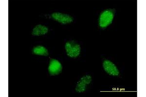 Immunofluorescence of purified MaxPab antibody to POLR3F on HeLa cell. (POLR3F 抗体  (AA 1-316))