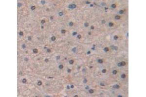 IHC-P analysis of Human Tissue, with DAB staining. (HIST1H2AJ 抗体  (AA 1-128))