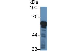 Detection of CYP11B1 in Rat Adrenal gland lysate using Polyclonal Antibody to Cytochrome P450 11B1 (CYP11B1) (CYP11B1 抗体  (AA 1-498))