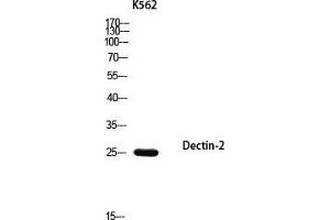 Western Blot (WB) analysis of K562 using Dectin-2 antibody.