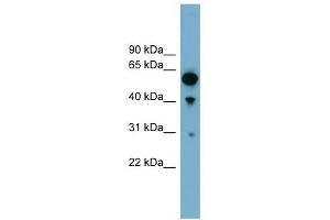 ARHGAP15 antibody used at 1 ug/ml to detect target protein. (ARHGAP15 抗体  (Middle Region))