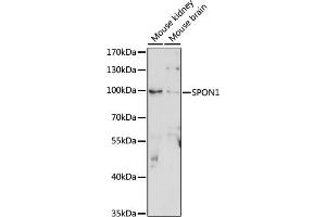 Western blot analysis of extracts of various cell lines, using SPON1 antibody (ABIN7270552) at 1:1000 dilution.
