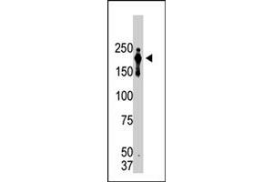 Western blot analysis of PRDM2 monoclonal antibody, clone 33AT1045  in lysate from transformed cells. (PRDM2 抗体  (AA 1-347))