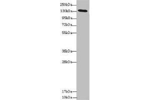 Western blot All lanes: NPHP3 antibody at 1. (NPHP3 抗体  (AA 1-130))