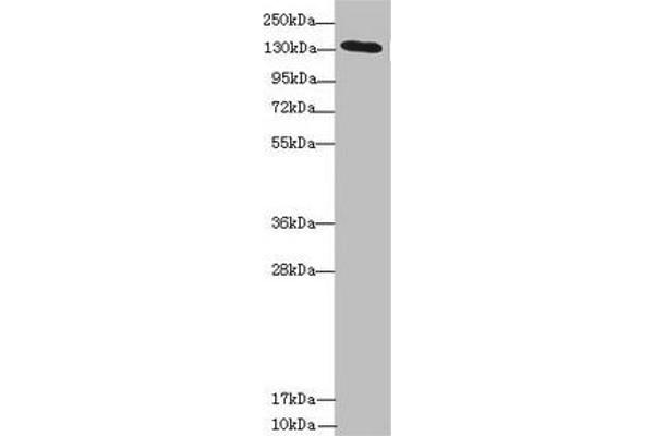 NPHP3 Antikörper  (AA 1-130)