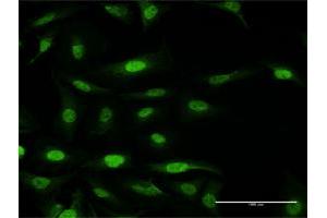 Immunofluorescence of purified MaxPab antibody to FANCF on HeLa cell.