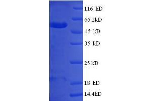 SDS-PAGE (SDS) image for Prion Incubation Time 1 (PITM1) (AA 1-238), (partial) protein (GST tag) (ABIN5712199) (PITM1 Protein (AA 1-238, partial) (GST tag))