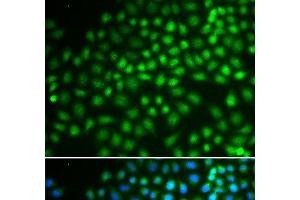 Immunofluorescence analysis of HeLa cells using SMARCA5 Polyclonal Antibody (SMARCA5 抗体)