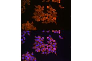 Immunofluorescence analysis of HeLa cells using ETF1 Rabbit pAb (ABIN6129660, ABIN6140313, ABIN6140314 and ABIN6221622) at dilution of 1:100 (40x lens). (ETF1 抗体  (AA 278-437))