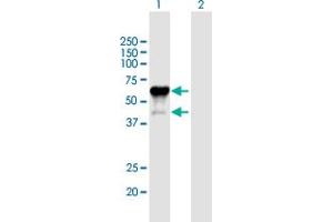 Western Blot analysis of P2RX4 expression in transfected 293T cell line by P2RX4 MaxPab polyclonal antibody. (P2RX4 抗体  (AA 1-388))