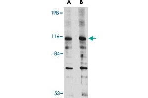 Western blot analysis of DLGAP2 in L1210 cell lysate with DLGAP2 polyclonal antibody  at (A) 0. (DLGAP2 抗体  (Internal Region))