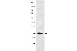 Western blot analysis of C1QL4 using HepG2 whole cell lysates (C1QL4 抗体  (Internal Region))