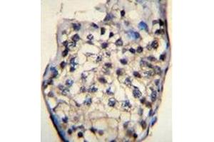 Immunohistochemistry (Paraffin-embedded Sections) (IHC (p)) image for anti-Outer Dense Fiber of Sperm Tails 3 (ODF3) (AA 177-207), (C-Term) antibody (ABIN953807)