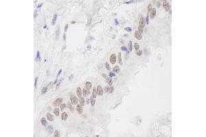 Immunohistochemistry (IHC) image for anti-Chromosome 11 Open Reading Frame 30 (C11orf30) (C-Term) antibody (ABIN7448552) (EMSY 抗体  (C-Term))