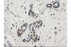 Immunohistochemical staining of paraffin-embedded Human breast tissue using anti-LENG1 mouse monoclonal antibody. (Leng1 抗体)