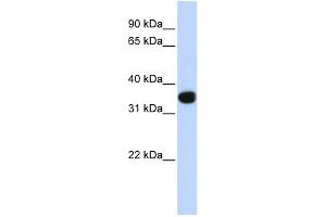 WB Suggested Anti-TLX1 Antibody Titration:  0. (TLX1 抗体  (Middle Region))