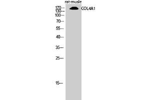 Western Blotting (WB) image for anti-Collagen, Type IV, alpha 1 (COL4A1) (N-Term) antibody (ABIN5956219) (COL4A1 抗体  (N-Term))