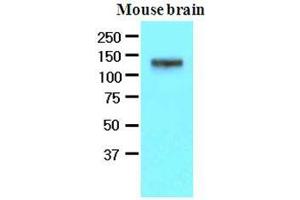 The extracts of mouse brain (50 ug) were resolved by SDS-PAGE, transferred to nitrocellulose membrane and probed with anti-human EphA2 (1:500). (EPH Receptor A2 抗体  (AA 559-976))