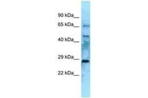 Image no. 1 for anti-Eyes Absent Homolog 4 (EYA4) (N-Term) antibody (ABIN6748312) (EYA4 抗体  (N-Term))