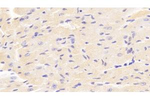 Detection of VAV1 in Mouse Cardiac Muscle Tissue using Polyclonal Antibody to Vav 1 Oncogene (VAV1) (VAV1 抗体  (AA 565-795))