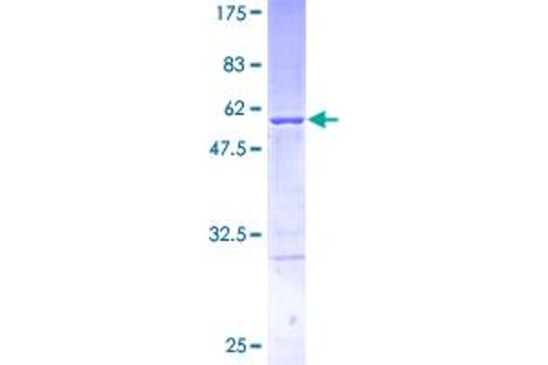 TPD52 Protein (AA 1-184) (GST tag)