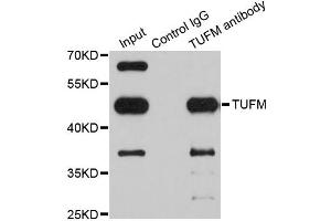 Immunoprecipitation analysis of 200ug extracts of Jurkat cells using 1ug TUFM antibody. (TUFM 抗体)