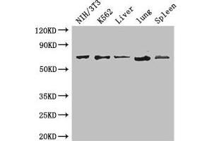 Western Blot Positive WB detected in: NIH/3T3 whole cell lysate, K562 whole cell lysate, Mouse liver tissue, Mouse lung tissue, Mouse spleen tissue All lanes: IL23R antibody at 3. (IL23R 抗体  (AA 15-125))
