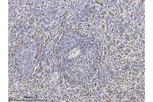 IHC analysis of SLC4A1 using anti-SLC4A1 antibody (ABIN7601075).