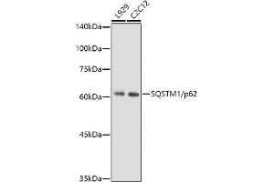 Western Blotting (WB) image for anti-Sequestosome 1 (SQSTM1) antibody (ABIN7270205)