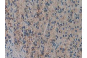 DAB staining on IHC-P; Samples: Rat Stomach Tissue (DOK7 抗体  (AA 63-320))