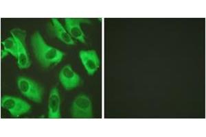Immunofluorescence analysis of HeLa cells, using Kir5.