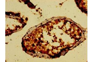 Immunohistochemistry (IHC) image for anti-NIMA (Never in Mitosis Gene A)- Related Kinase 9 (NEK9) (AA 821-979) antibody (ABIN7169116)