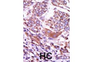 Immunohistochemistry (IHC) image for anti-Calcium/calmodulin-Dependent Protein Kinase II delta (CAMK2D) antibody (ABIN5023065) (CAMK2D 抗体)