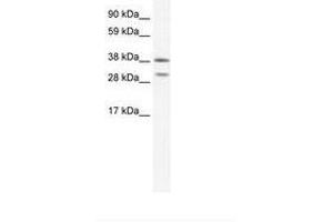 Image no. 1 for anti-NK2 Homeobox 3 (NKX2-3) (AA 34-83) antibody (ABIN202180)