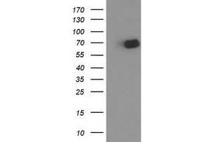 HEK293T cells were transfected with the pCMV6-ENTRY control (Left lane) or pCMV6-ENTRY OGFOD1 (Right lane) cDNA for 48 hrs and lysed. (OGFOD1 抗体)