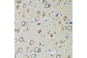 Immunohistochemistry of paraffin-embedded rat brain using RPS10 antibody (ABIN1980247) at dilution of 1:100 (40x lens). (RPS10 抗体)