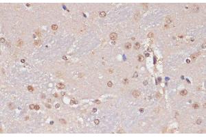 Immunohistochemistry (Paraffin-embedded Sections) (IHC (p)) image for anti-P53-Induced Death Domain Protein (PIDD) antibody (ABIN7261141)