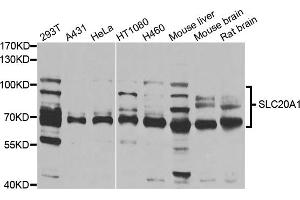 Western blot analysis of extracts of various cell lines, using SLC20A1 antibody.