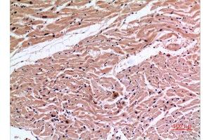 Immunohistochemistry (IHC) analysis of paraffin-embedded Human Heart, antibody was diluted at 1:100. (XRCC6 抗体  (Ser402))